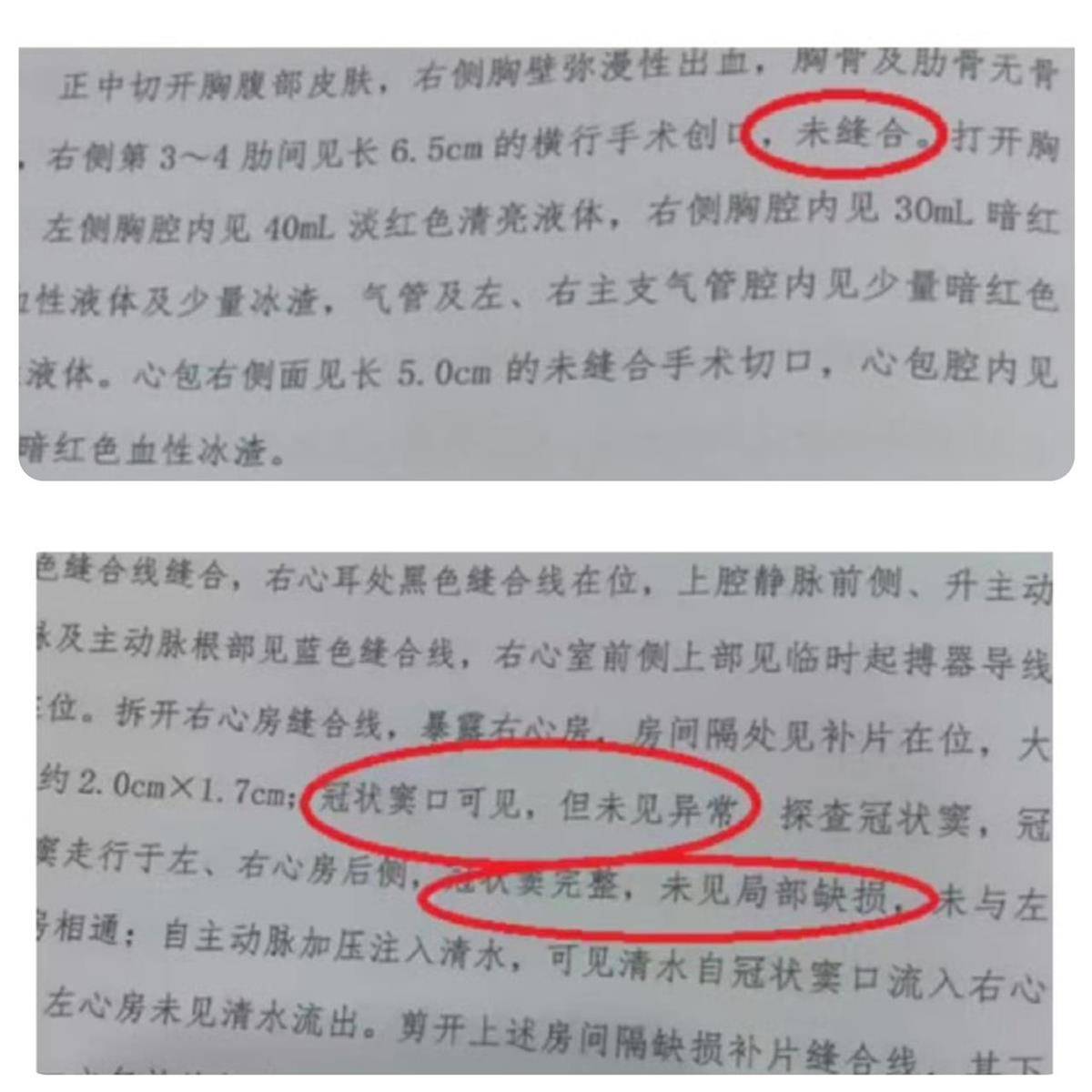 怎么开通皇冠信用网口_宁波夭折女婴小洛熙部分尸检报告公布怎么开通皇冠信用网口，显示6.5厘米创口未缝合，父亲：会择期公布完整报告